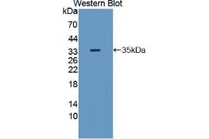 Western blot analysis of the recombinant protein. (SHP1 antibody  (AA 244-515))