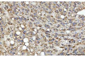 IHC analysis of MSF/SEPTIN9 using anti-MSF/SEPTIN9 antibody (ABIN7600104). (Septin 9 antibody  (AA 15-282))