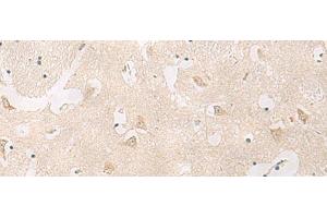Immunohistochemistry of paraffin-embedded Human brain tissue using GPR83 Polyclonal Antibody at dilution of 1:60(x200)