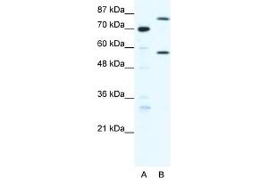 WB Suggested Anti-MYNN Antibody Titration:  1. (Myoneurin antibody  (Middle Region))