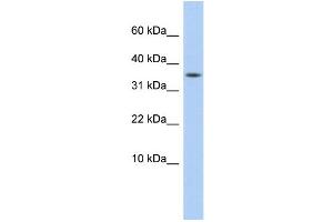 WB Suggested Anti-DYSFIP1 Antibody Titration: 0. (PPP1R27 antibody  (Middle Region))