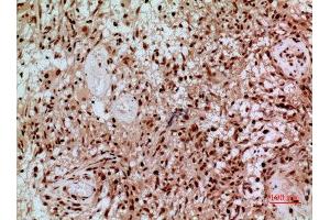Immunohistochemistry (IHC) analysis of paraffin-embedded Human Brain, antibody was diluted at 1:100. (SAMHD1 antibody  (Internal Region))