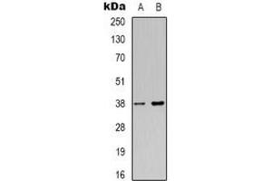 Western blot analysis of NDRG4 expression in Jurkat (A), HepG2 (B) whole cell lysates. (NDRG4 antibody)