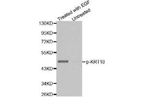 Western blot analysis of extracts from HT29 cells untreated or treated with EGF using Phospho-KRT18-S33 antibody. (Cytokeratin 18 antibody  (pSer33))