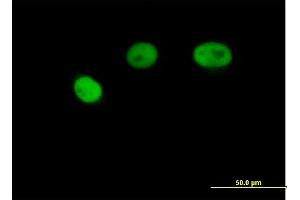 Immunofluorescence of purified MaxPab antibody to PSMB7 on HeLa cell. (PSMB7 antibody  (AA 1-277))