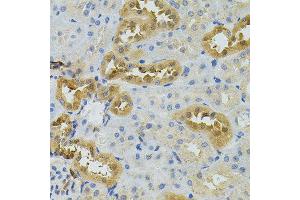 Immunohistochemistry of paraffin-embedded rat kidney using NAT8 antibody. (NAT8 antibody)