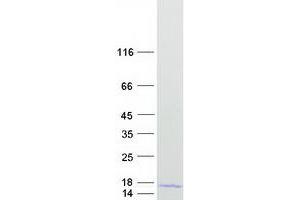 Validation with Western Blot
