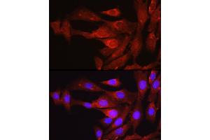 Immunofluorescence (IF) image for anti-Proprotein Convertase Subtilisin/kexin Type 9 (PCSK9) (C-Term) antibody (ABIN6145328)