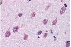 Brain, cortex, Human: Formalin-Fixed, Paraffin-Embedded (FFPE) (IGSF8 antibody  (Internal Region))