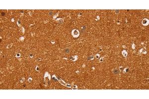 Immunohistochemistry of paraffin-embedded Human brain tissue using TNFRSF8 Polyclonal Antibody at dilution 1:60 (TNFRSF8 antibody)