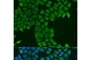 Immunofluorescence analysis of U2OS cells using CDK16 Polyclonal Antibody at dilution of 1:100. (CDK16 antibody)