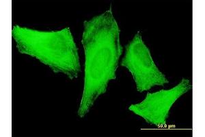 Immunofluorescence of monoclonal antibody to MYH9 on HeLa cell. (Myosin 9 antibody  (AA 131-220))