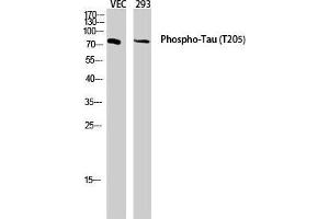 Western Blot (WB) analysis of VEC 293 lysis using Phospho-Tau (T205) antibody. (tau antibody  (pThr205))