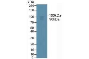 Detection of ADAM17 in Human U937 Cells using Monoclonal Antibody to A Disintegrin And Metalloprotease 17 (ADAM17) (ADAM17 antibody  (AA 226-473))