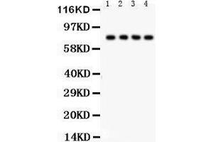 Western Blotting (WB) image for anti-Tumor Necrosis Factor Receptor Superfamily, Member 1B (TNFRSF1B) (AA 288-318), (C-Term) antibody (ABIN3042335) (TNFRSF1B antibody  (C-Term))