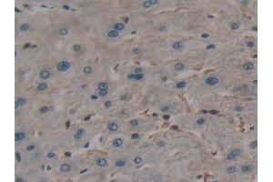 Detection of TL1A in Human Liver Tissue using Polyclonal Antibody to TNF Like Ligand 1A (TL1A) (TNF Like Ligand 1A (AA 67-251) antibody)
