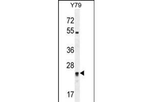 RP11-529I10. (DPCD antibody  (AA 96-136))
