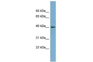 WB Suggested Anti-RP2 Antibody Titration: 0. (RP2 antibody  (Middle Region))