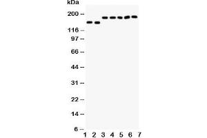 Western blot testing of DCC antibody and Lane 1:  rat brain;  2: mouse brain;  and human samples 3: U87;  4: SW620;  5: COLO320;  6: 293T;  7: HeLa cell lysate.