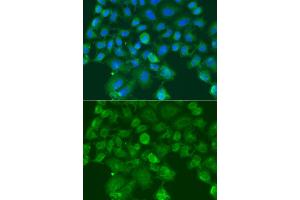 Immunofluorescence analysis of A549 cells using CST1 antibody (ABIN6293854).