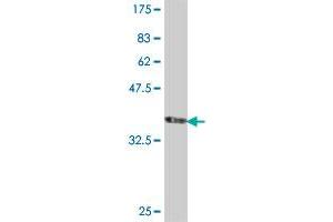 Western Blot detection against Immunogen (35. (CACNB2 antibody  (AA 213-301))