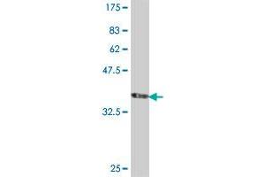 Western Blot detection against Immunogen (35. (CACNB2 antibody  (AA 213-301))