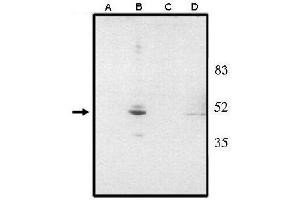 Image no. 1 for anti-Visual System Homeobox 2 (VSX2) (AA 1-131), (N-Term) antibody (ABIN265011) (VSX2 antibody  (N-Term))