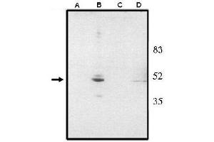 VSX2 antibody  (N-Term)