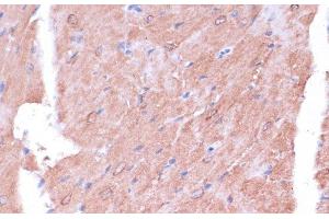 Immunohistochemistry of paraffin-embedded Mouse heart using TIMM8B Polyclonal Antibody at dilution of 1:100 (40x lens). (TIMM8B antibody)