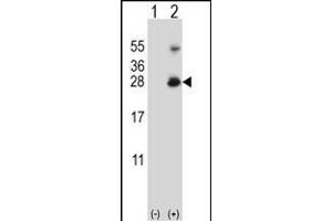 Western blot analysis of RNF11 (arrow) using rabbit polyclonal RNF11 Antibody (Center) (ABIN656832 and ABIN2846041). (RNF11 antibody  (AA 64-90))
