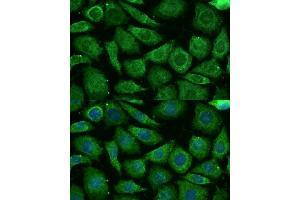 Immunofluorescence analysis of L929 cells using NDUFB3 Polyclonal Antibody (ABIN7268810) at dilution of 1:100 (40x lens). (NDUFB3 antibody  (AA 1-98))