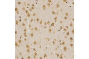 Immunohistochemistry (IHC) image for anti-Mdm2, p53 E3 Ubiquitin Protein Ligase Homolog (Mouse) (MDM2) (AA 130-230) antibody (ABIN3020951)