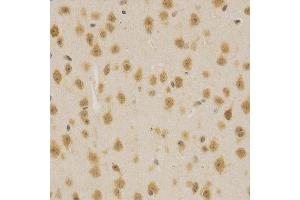 Immunohistochemistry of paraffin-embedded mouse brain using MDM2 antibody at dilution of 1:200 (x400 lens). (MDM2 antibody  (AA 130-230))