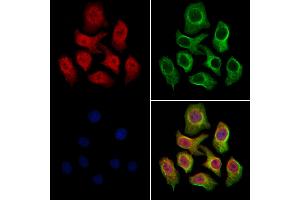anti-Structural Maintenance of Chromosomes 1B (SMC1B) (C-Term) antibody