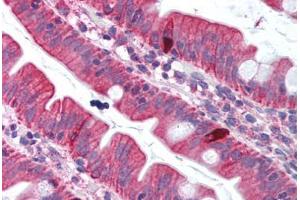 Human Small Intestine (formalin-fixed, paraffin-embedded) stained with TNFSF11 antibody ABIN214007 at 5 ug/ml followed by biotinylated goat anti-rabbit IgG secondary antibody ABIN481713, alkaline phosphatase-streptavidin and chromogen. (RANKL antibody  (Internal Region))