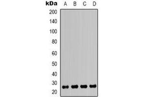 Western blot analysis of HMGB1 expression in Jurkat (A), K562 (B), MCF7 (C), A549 (D) whole cell lysates. (HMGB1 antibody)