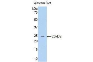 Western Blotting (WB) image for anti-Interleukin 10 Receptor, beta (IL10RB) (AA 42-218) antibody (ABIN1859330) (IL10RB antibody  (AA 42-218))