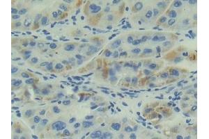 Immunohistochemistry (IHC) image for anti-Adrenomedullin (ADM) (AA 22-147) antibody (ABIN7431344)