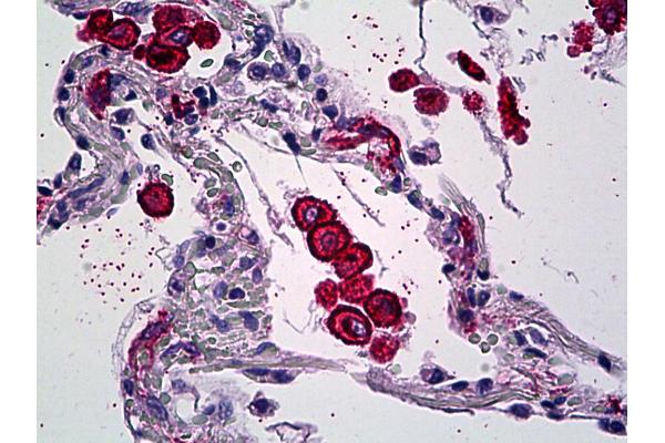 Mannose Receptor antibody  (AA 22-131)