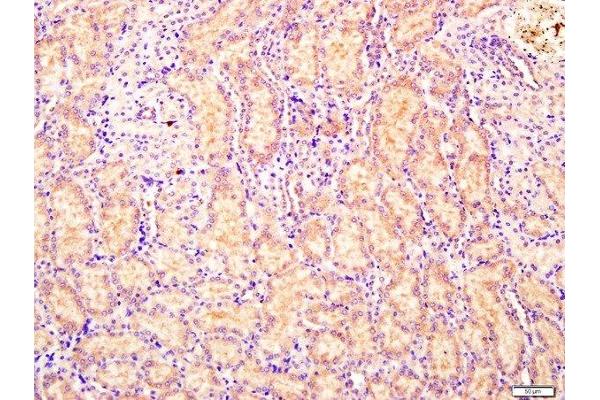 CEMIP antibody  (AA 101-200)