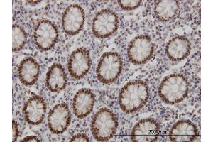 Immunoperoxidase of monoclonal antibody to FOXA1 on formalin-fixed paraffin-embedded human colon. (FOXA1 antibody  (AA 367-472))
