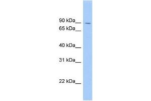 WB Suggested Anti-SATB1 Antibody Titration: 0. (SATB1 antibody  (Middle Region))