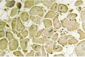 Immunohistochemistry (IHC) analyzes of Cytochrome b5 antibody in paraffin-embedded human heart tissue. (CYB5R3 antibody)