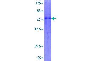 WNT5B Protein (AA 1-359) (GST tag)