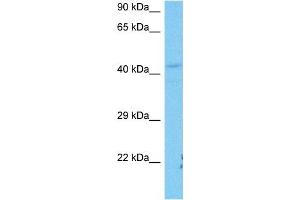 Host:  Mouse  Target Name:  SFTPB  Sample Tissue:  Mouse Liver  Antibody Dilution:  1ug/ml (SFTPB antibody  (Middle Region))