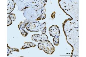 IHC analysis of MRE11 using anti-MRE11 antibody (ABIN7600025). (Mre11 antibody  (AA 14-481))