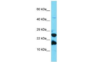Host: Rabbit Target Name: A2LD1 Sample Type: Jurkat Whole Cell lysates Antibody Dilution: 1. (GGACT antibody  (N-Term))