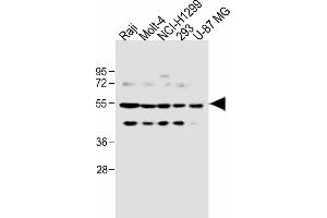 All lanes : Anti-PFKFB4 Antibody (Center) at 1:1000 dilution Lane 1: Raji, whole cell lysate Lane 2: Molt-4 whole cell lysate Lane 3: NCI- whole cell lysate Lane 4: 293 whole cell lysate Lane 5: U-87 MG whole cell lysate Lysates/proteins at 20 μg per lane. (PFKFB4 antibody  (AA 266-296))