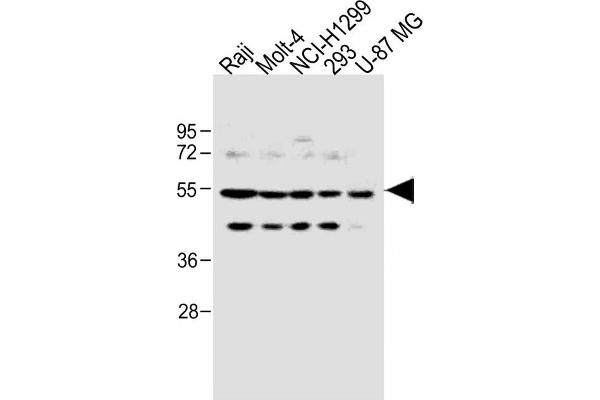 PFKFB4 Antikörper  (AA 266-296)