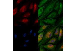 ABIN7094526 and ABIN7098575 staining  cells by IF/ICC.